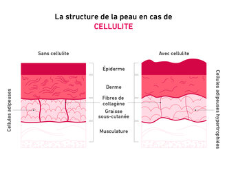Graphique expliquant le lien entre le collagène et la cellulite